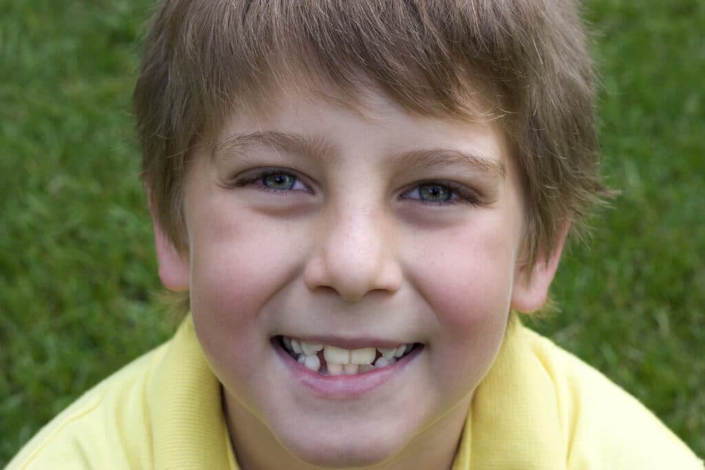 Smiling orthodontic patient.