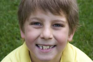 Smiling orthodontic patient.