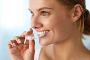 Woman placing clear aligner in mouth whilst having orthodontic treatment.