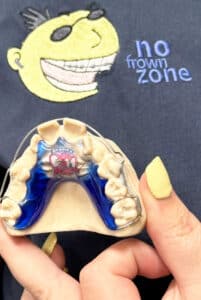 Customised orthodontic plate.